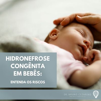 Hidronefrose Congênita em Bebês