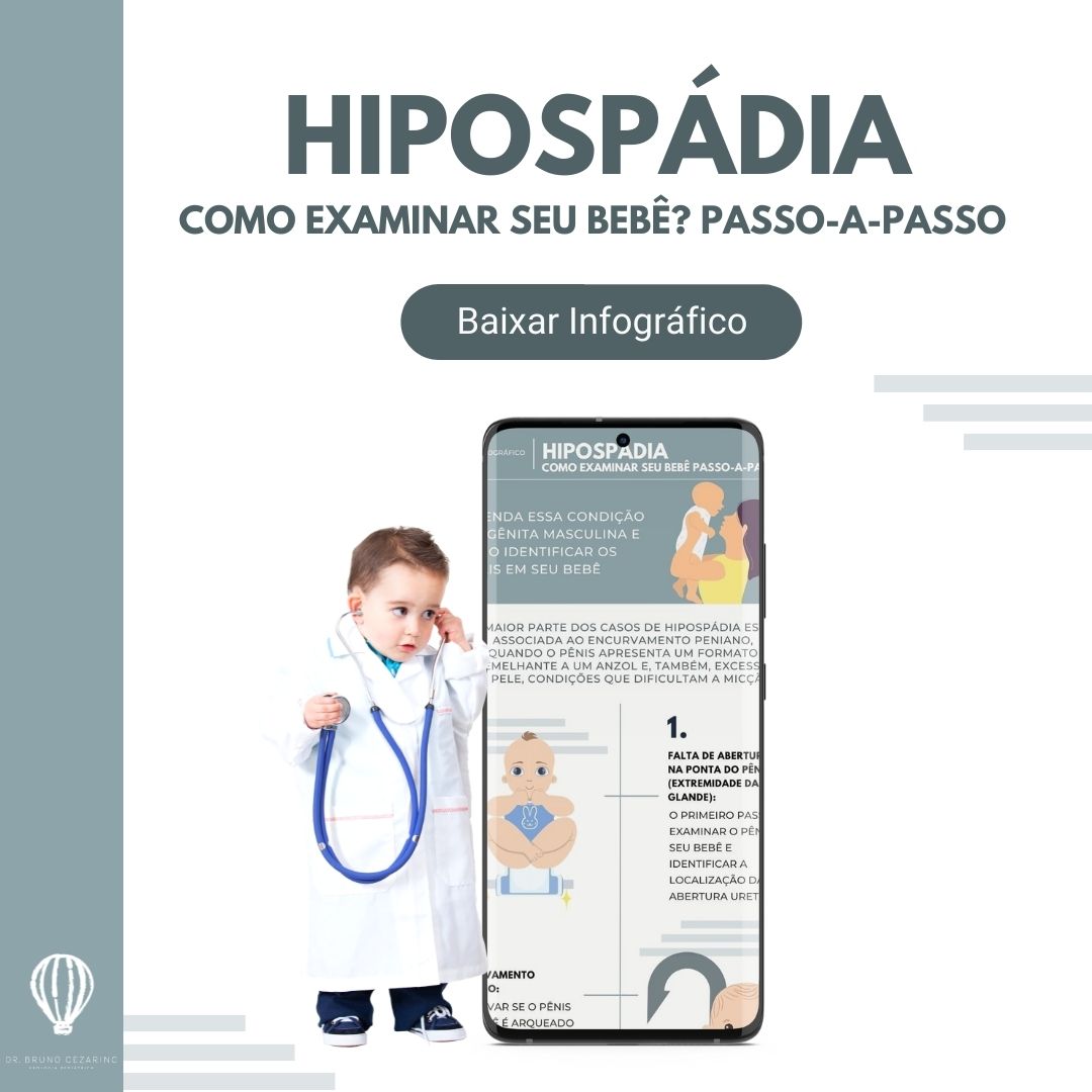 Hipospádia: como examinar o seu bebê passo-a-passo