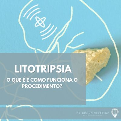 Litotripsia
