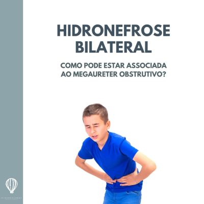hidronefrose bilateral