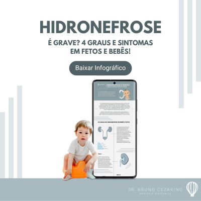 hidronefrose